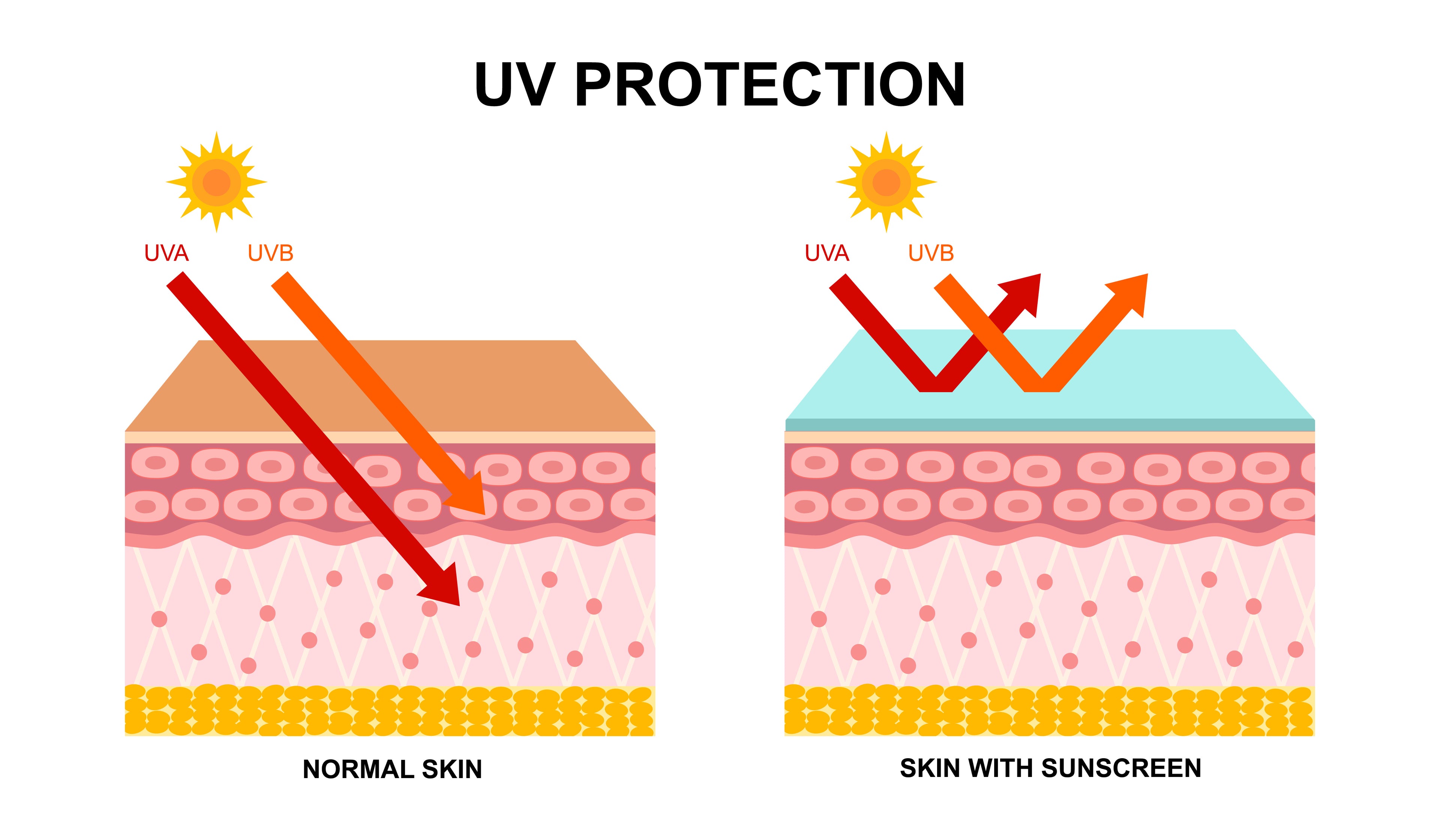 Diagram showing UV protection on normal skin versus skin with sunscreen.